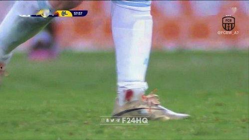 明星脚流血,明星脚部意外流血瞬间